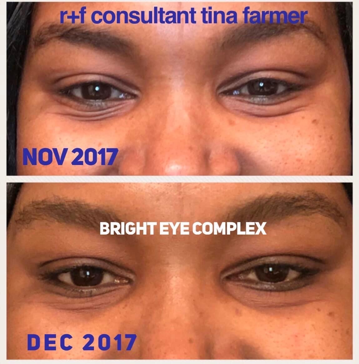 Eye Cream Results 