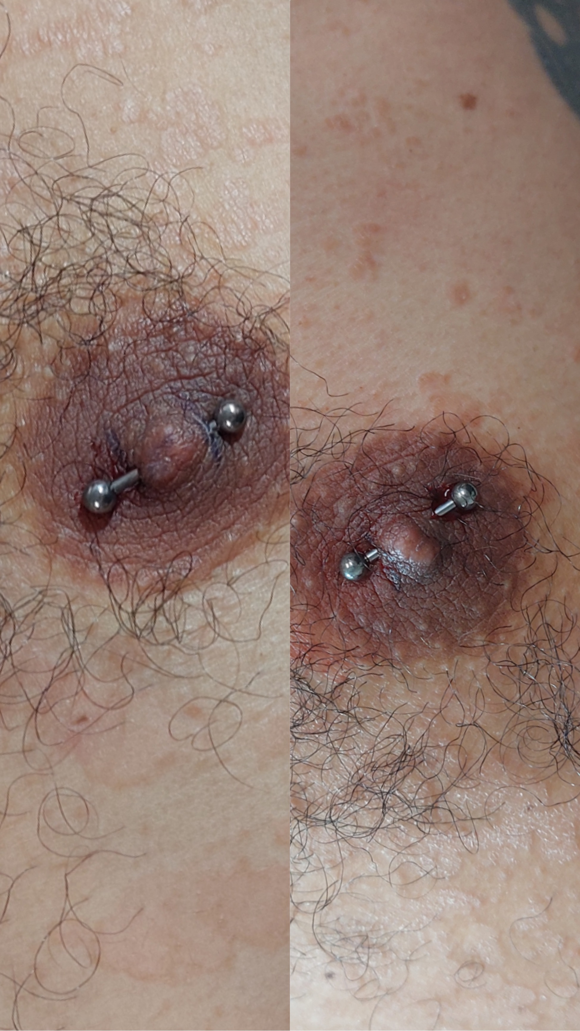 Nipples maschili
