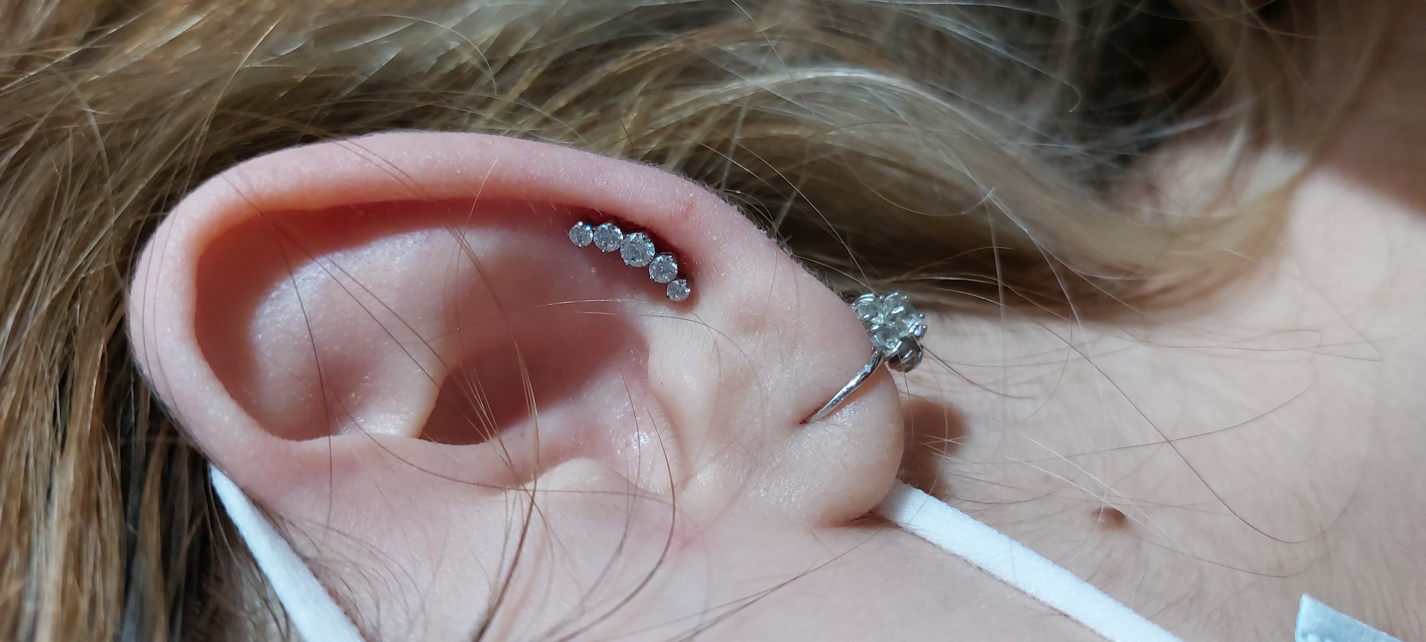 Middle helix