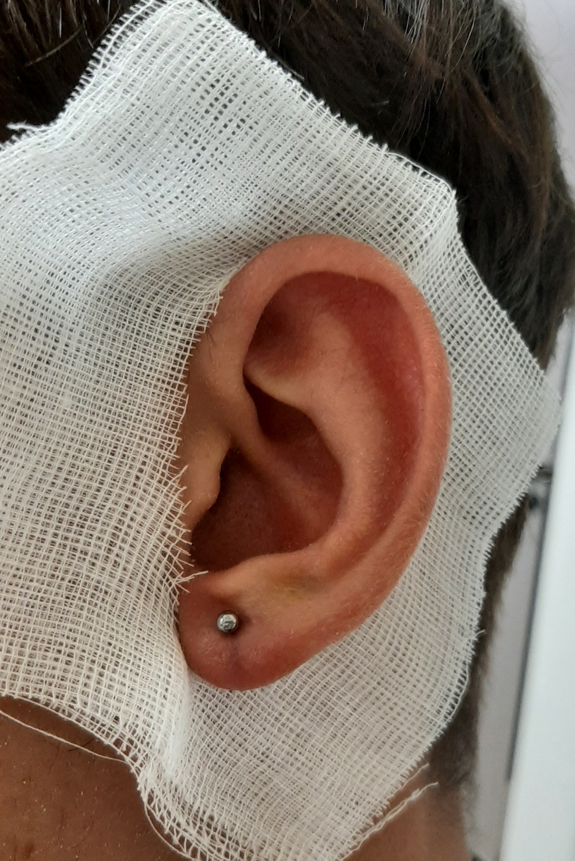 Ear lobe piercing